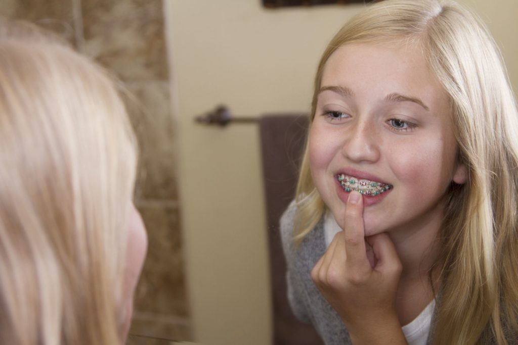Orthodontics for all Ages